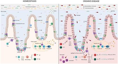 Bacterial Translocation as Inflammatory Driver in Crohn’s Disease